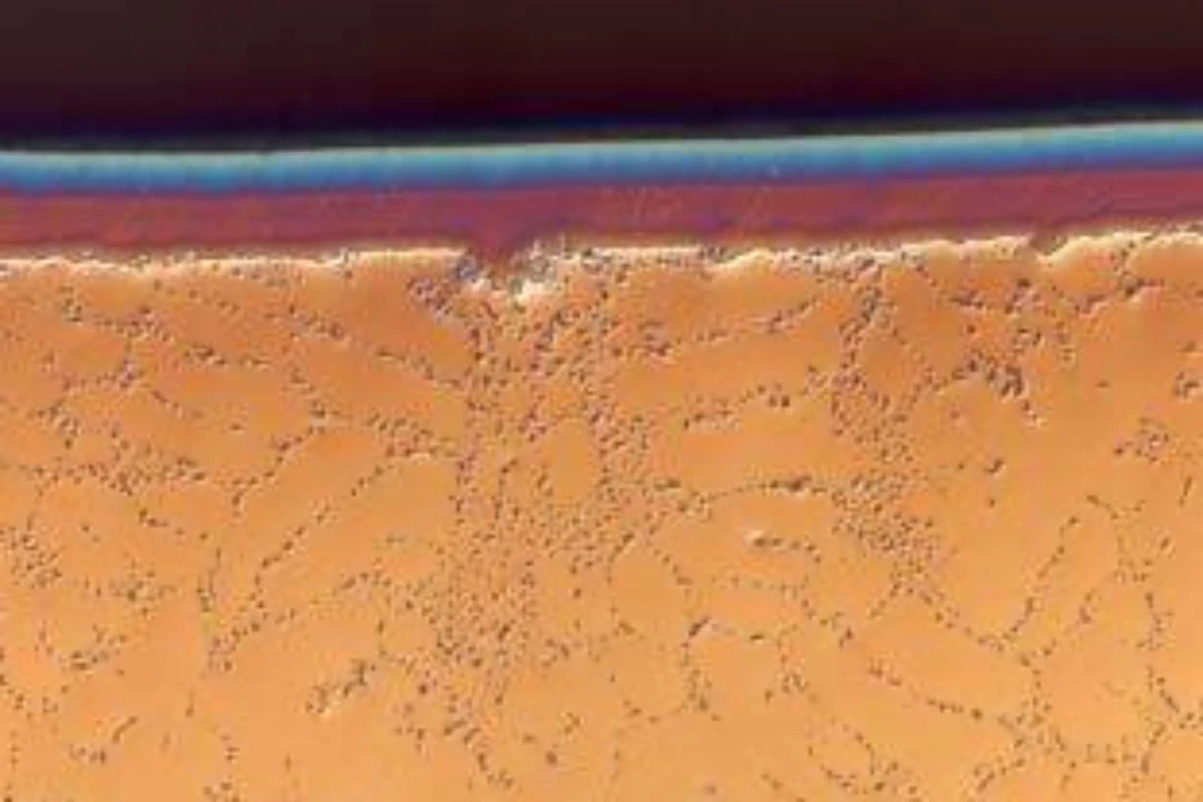 micrograph of cast aluminum